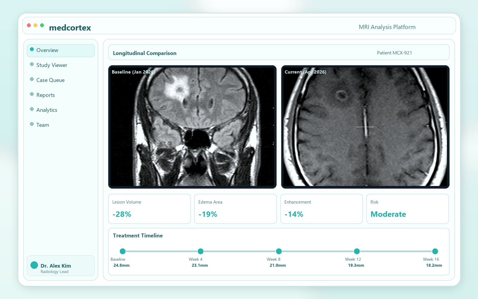 Progress comparison panel between two MRI exams